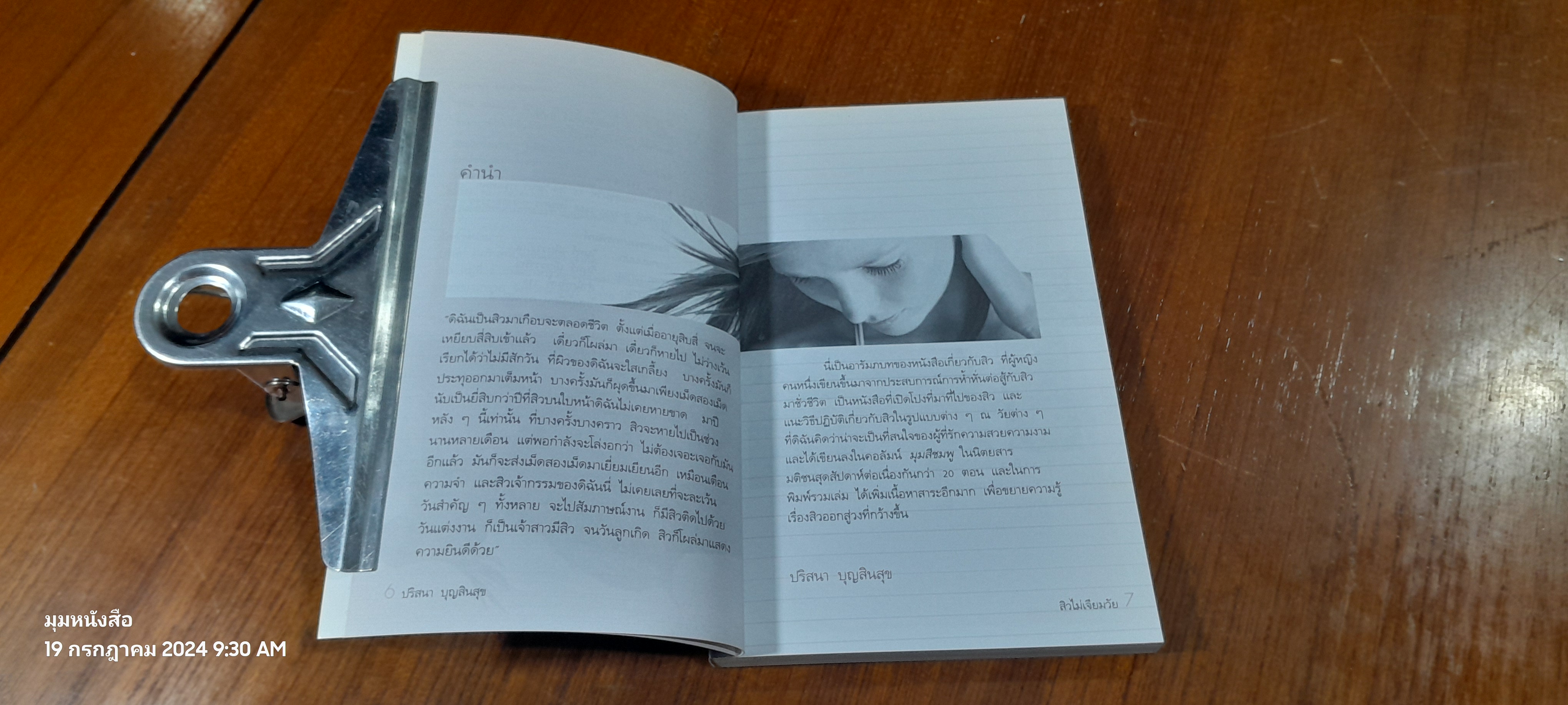 สิวไม่เจียมวัย / ปริสนา บุญสินสุข