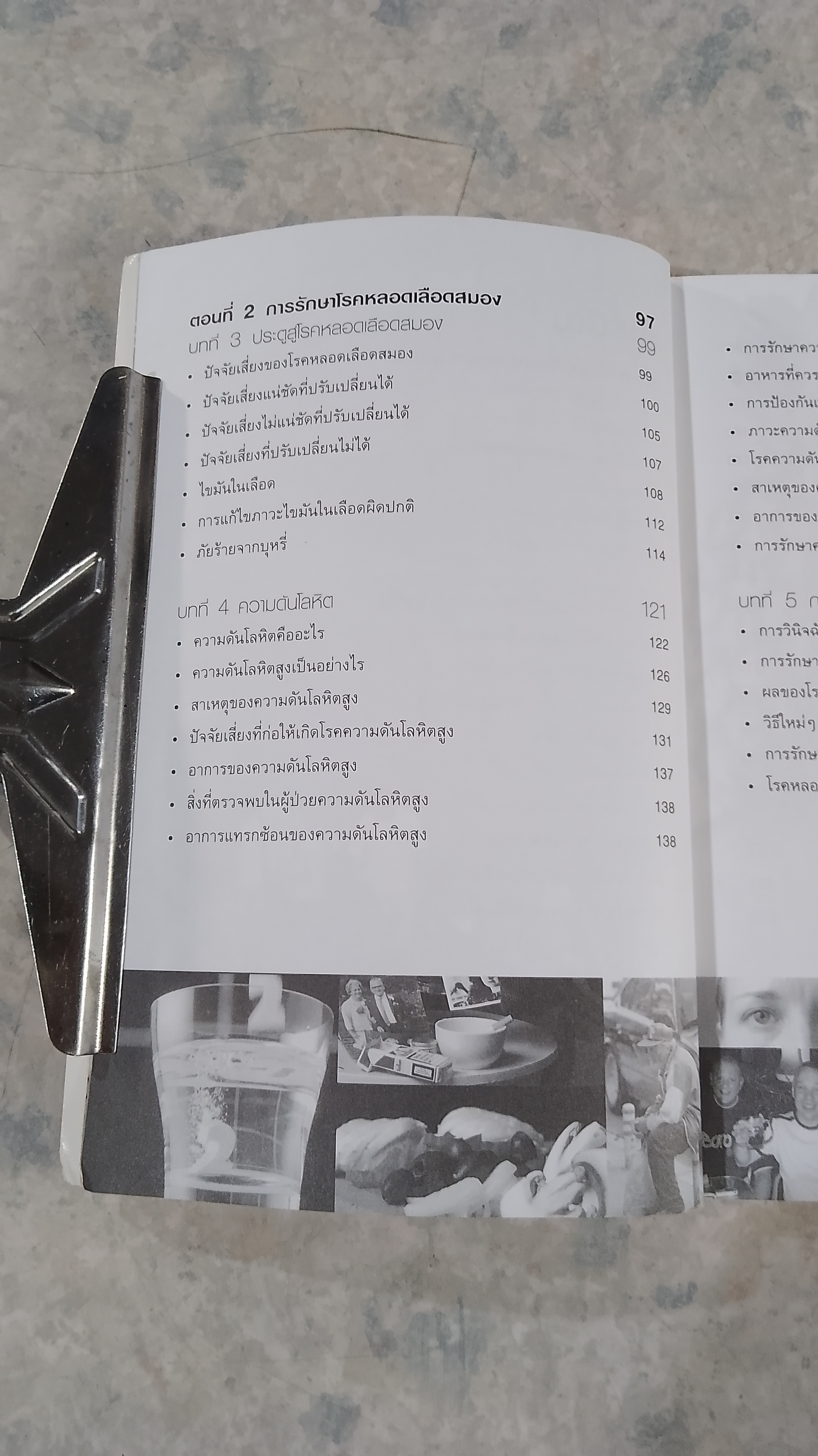 STROKE ฆาตกรเงียบ / แพทย์หญิงเพ็ญแข แดงสุวรรณ