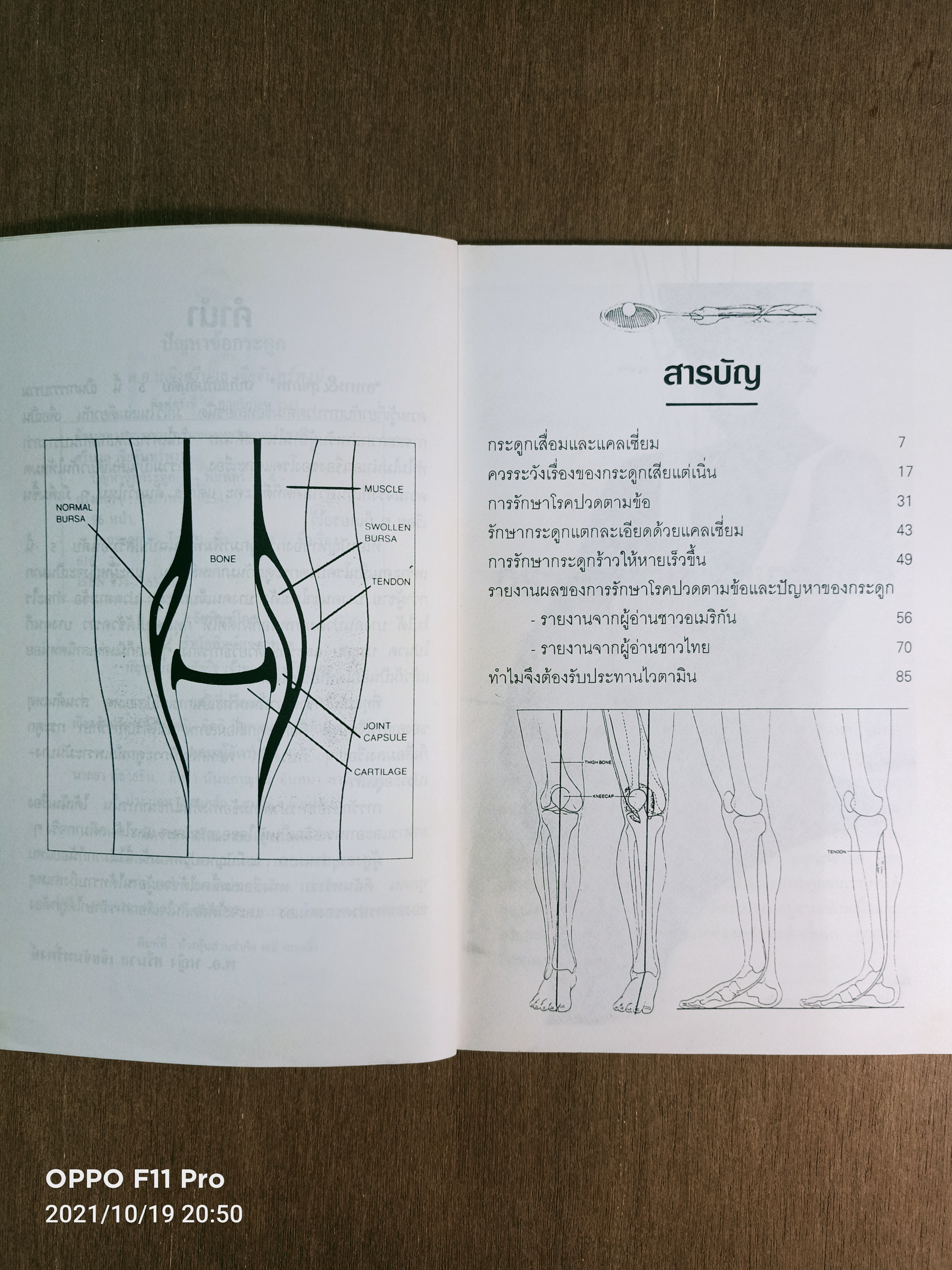 ปัญหาข้อกระดูก / พ.อ. หญิงศรีนวล เจียจันทร์พงษ์ แปลและเรียบเรียง
