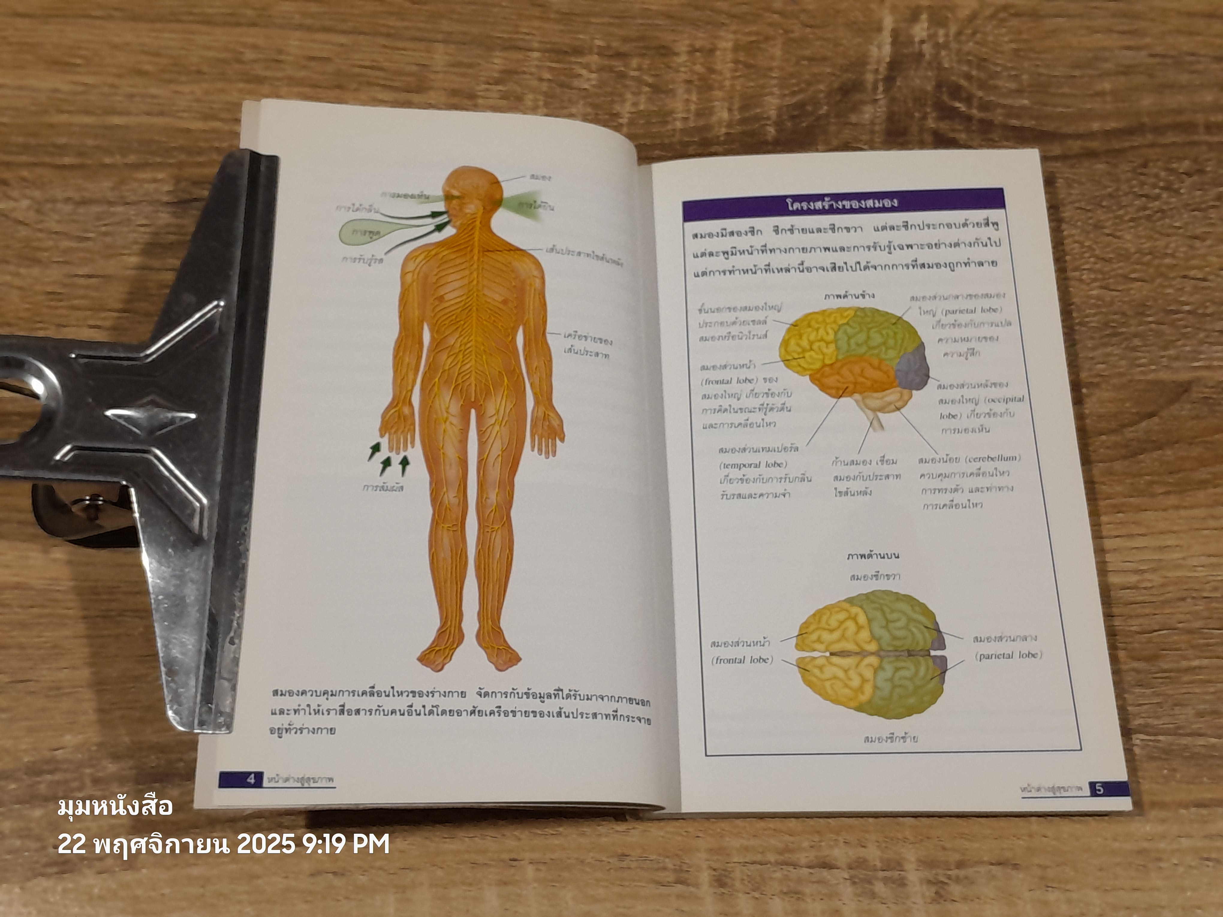 โรคลมปัจจุบัน (STROKE) (หลอดเลือดสมองตีบหรือแตก) / Dr. Richard Lindley