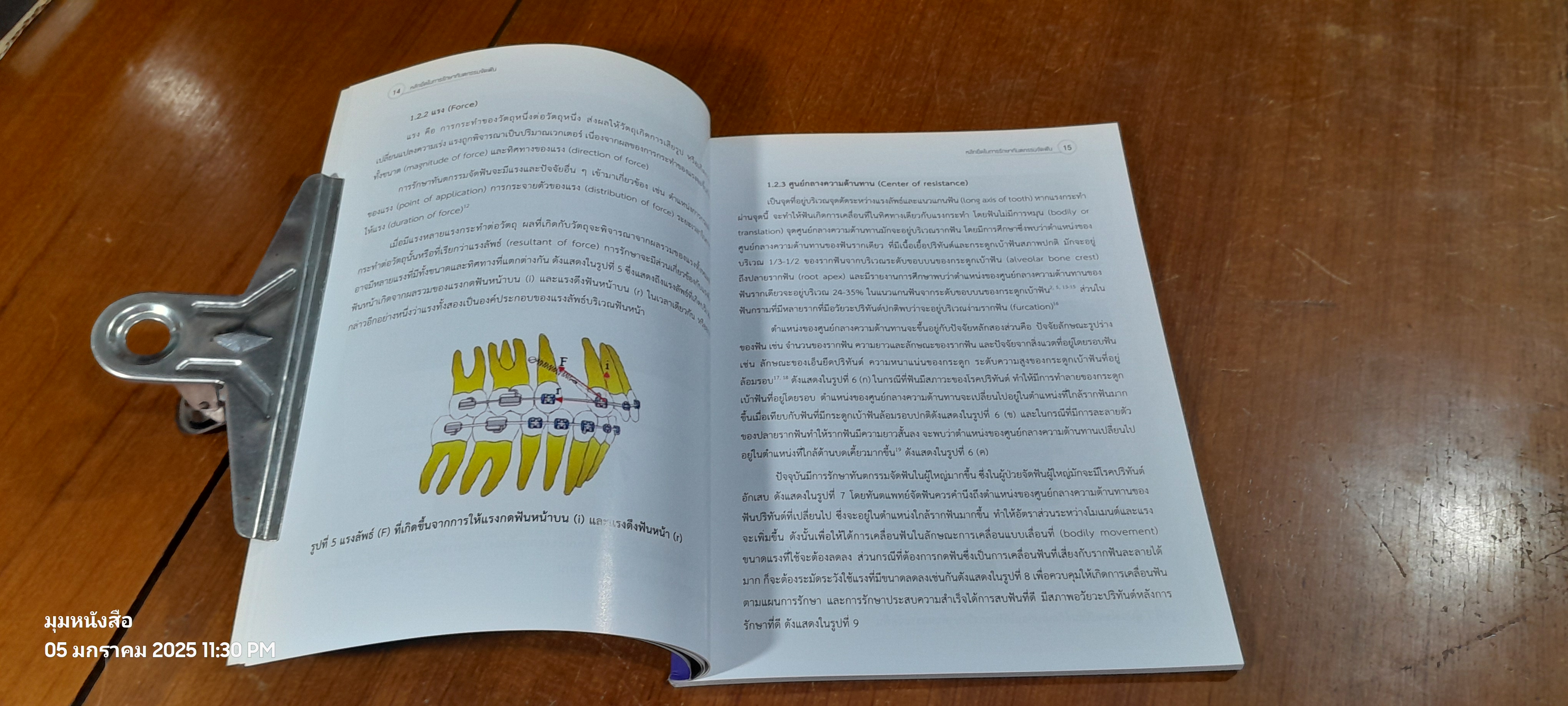หลักยึดในการรักษาทันตกรรมจัดฟัน / ผศ.ดร.ทพ.พูนศักดิ์ ภิเศก
