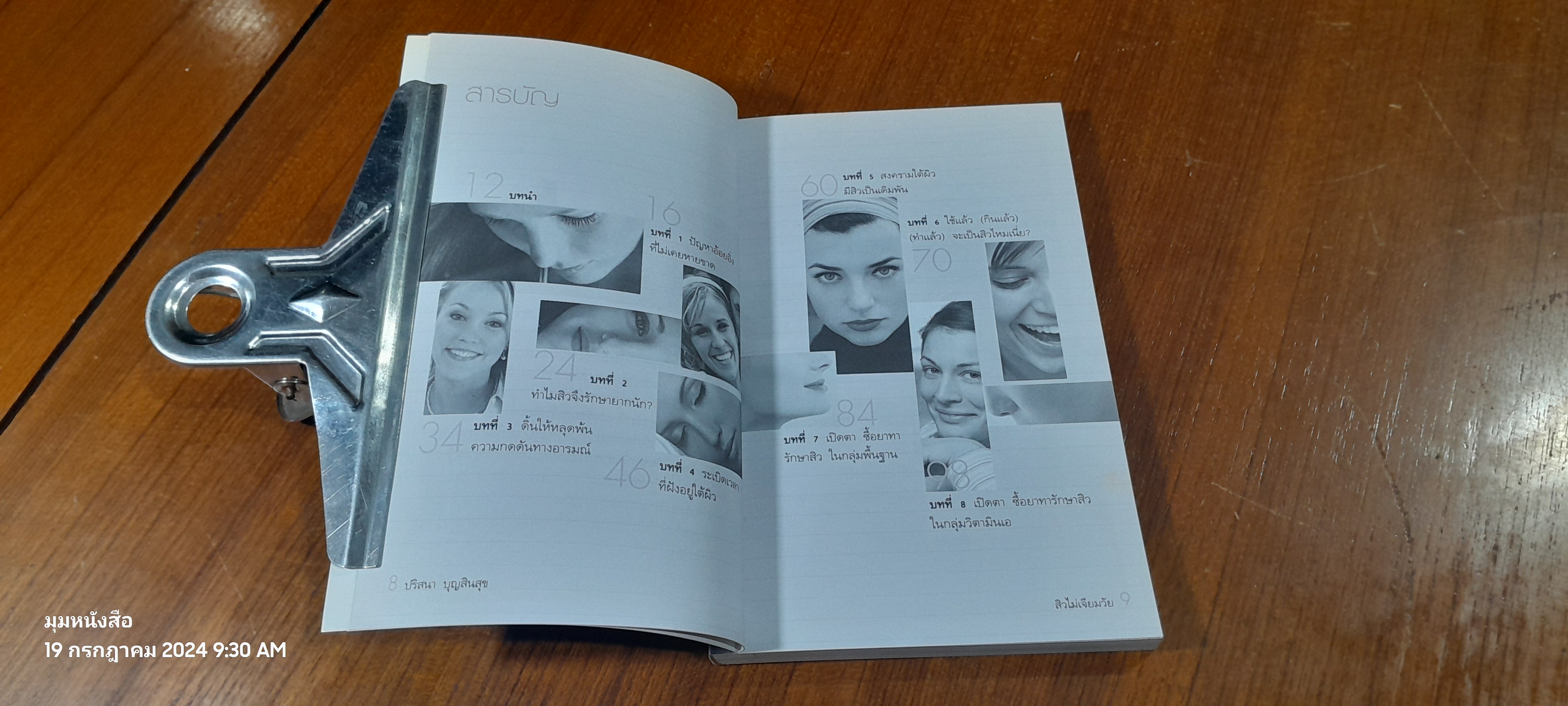 สิวไม่เจียมวัย / ปริสนา บุญสินสุข