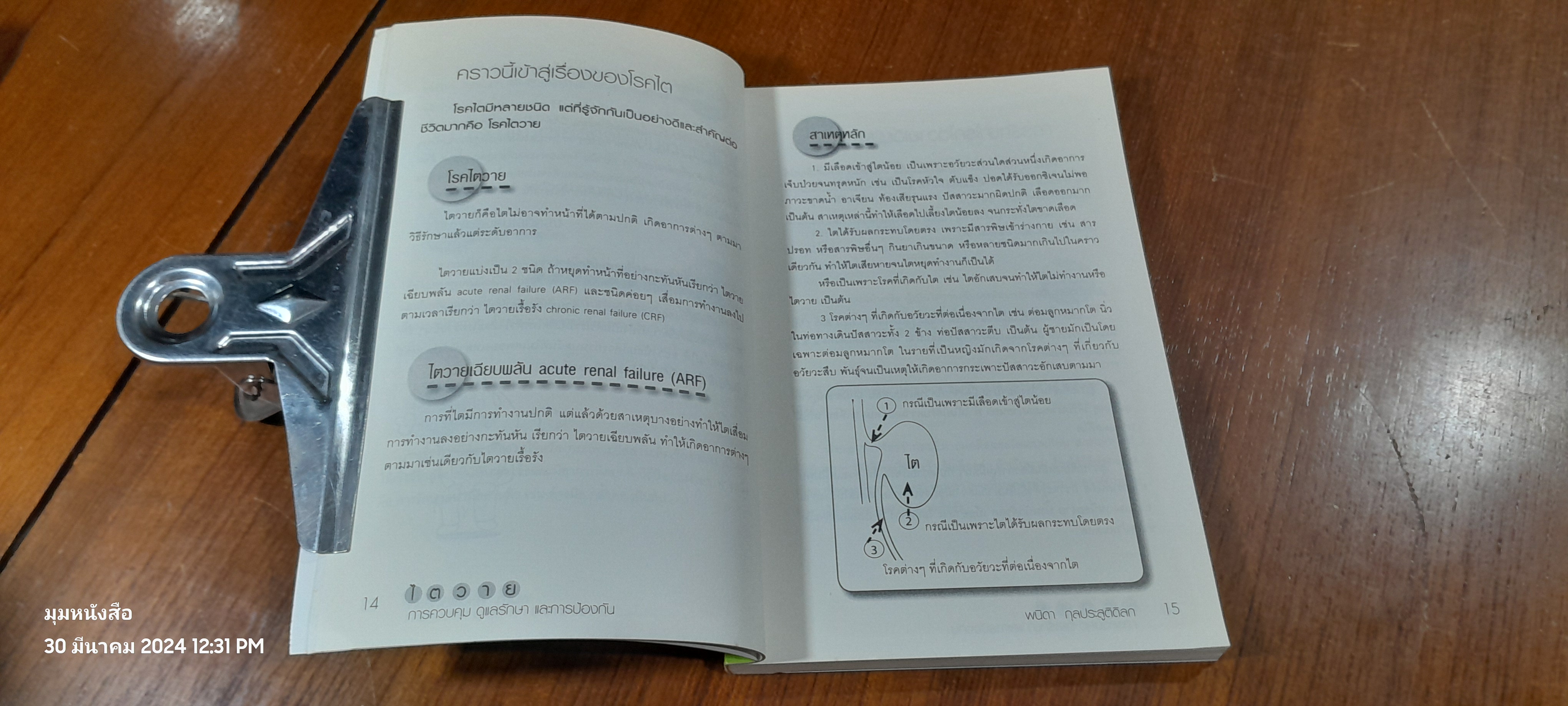 ไตวาย การควบคุม ดูแลรักษา และ การป้องกัน / พนิดา กุลประสูติดิลก