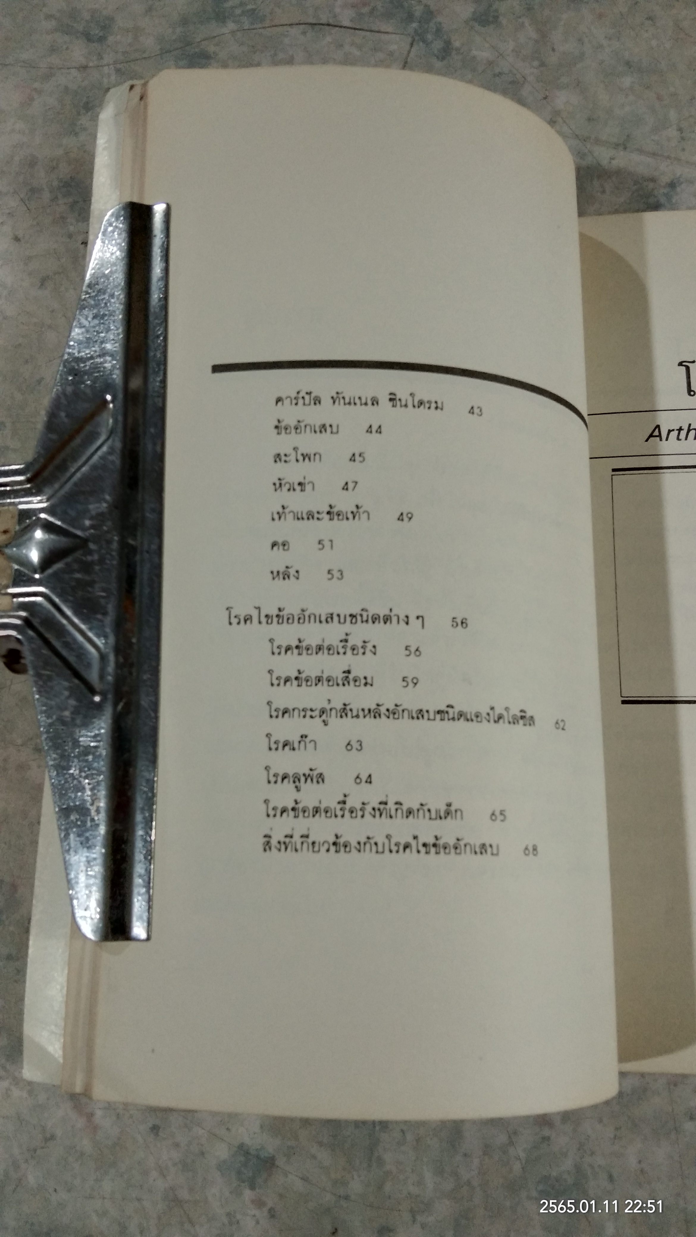 ไขข้ออักเสบ / นพ.เรย์มอนด์ พาทริดจ์