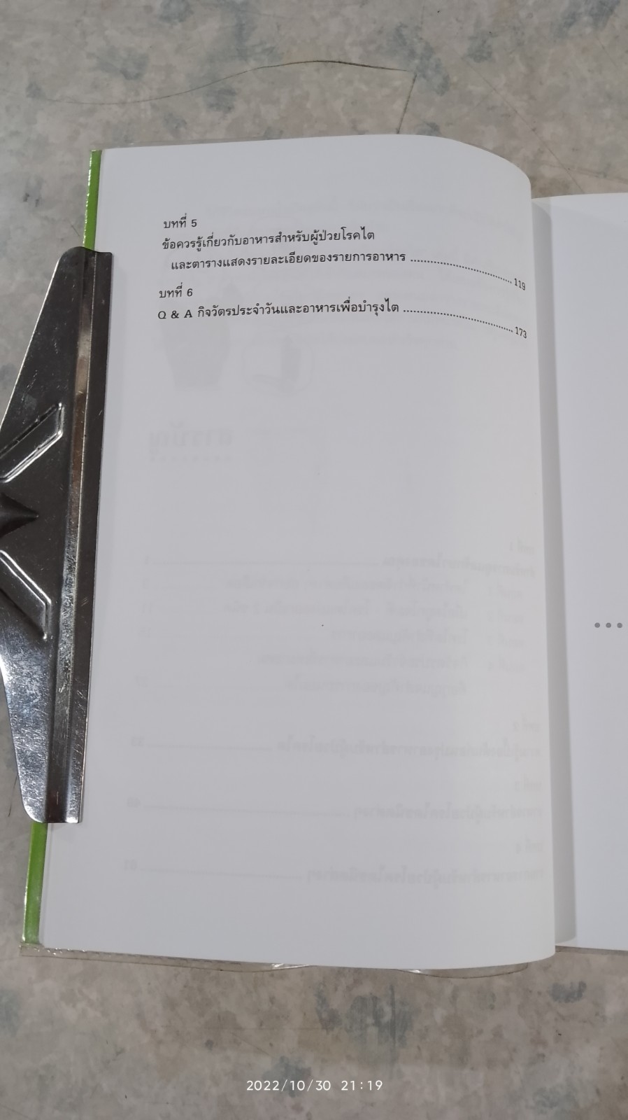 การดูแลผู้ป่วยโรคไต / พนิดา กุลประสูติดิลก