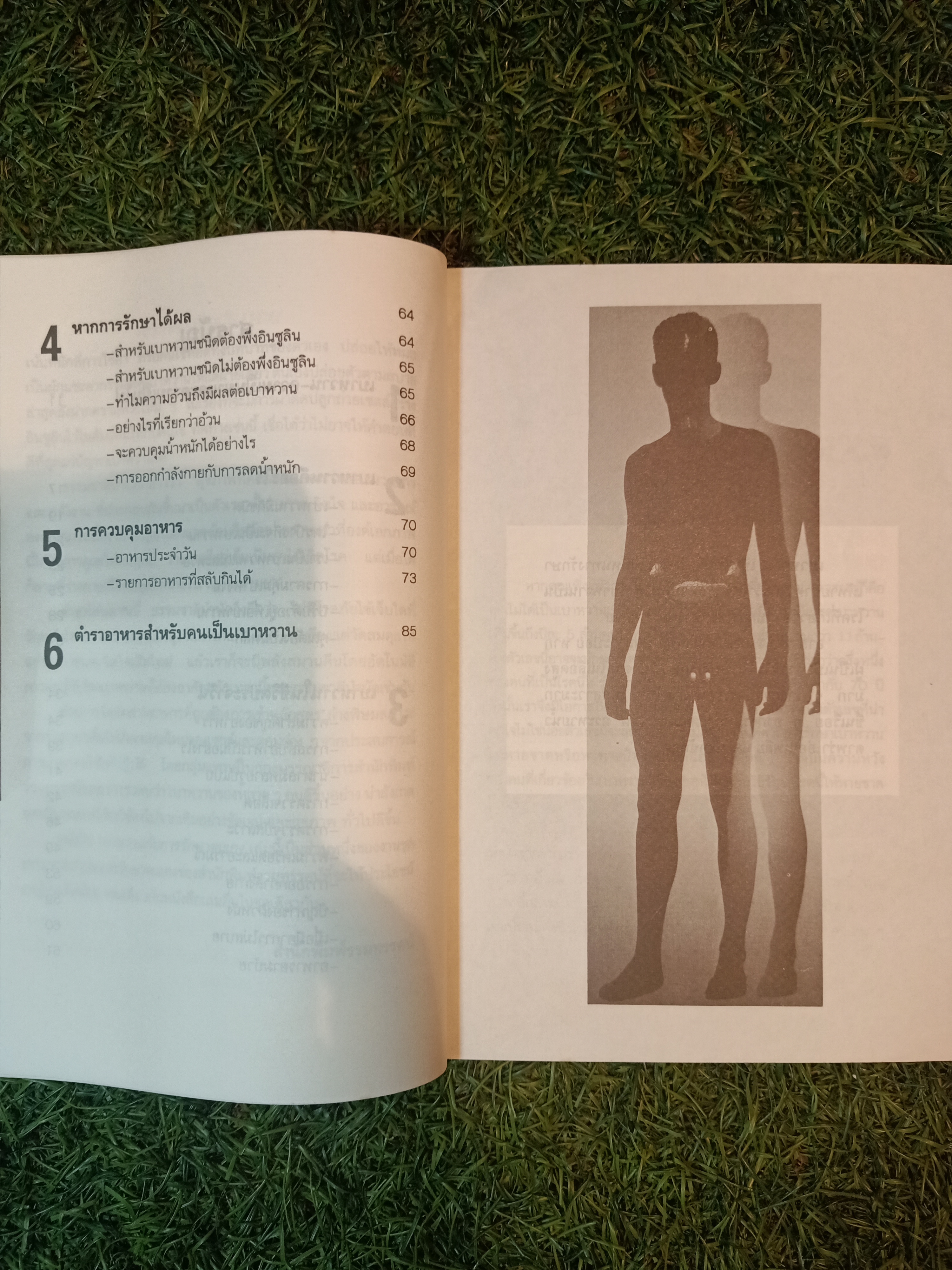 เบาหวาน กับการรักษาตนเอง / นพ. ไพบูลย์ จาตุรปัญญา