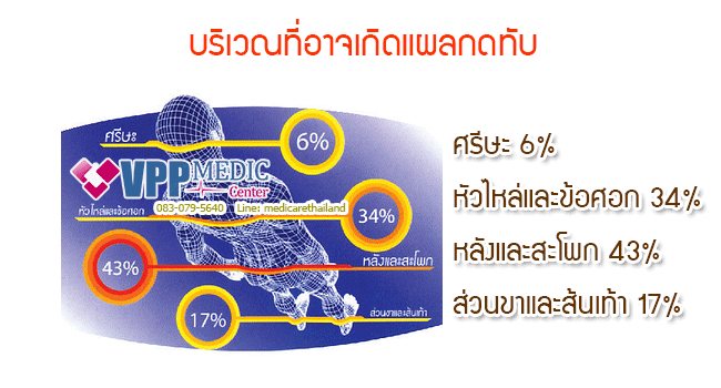 บริเวณที่อาจเกิดแผลกดทับ