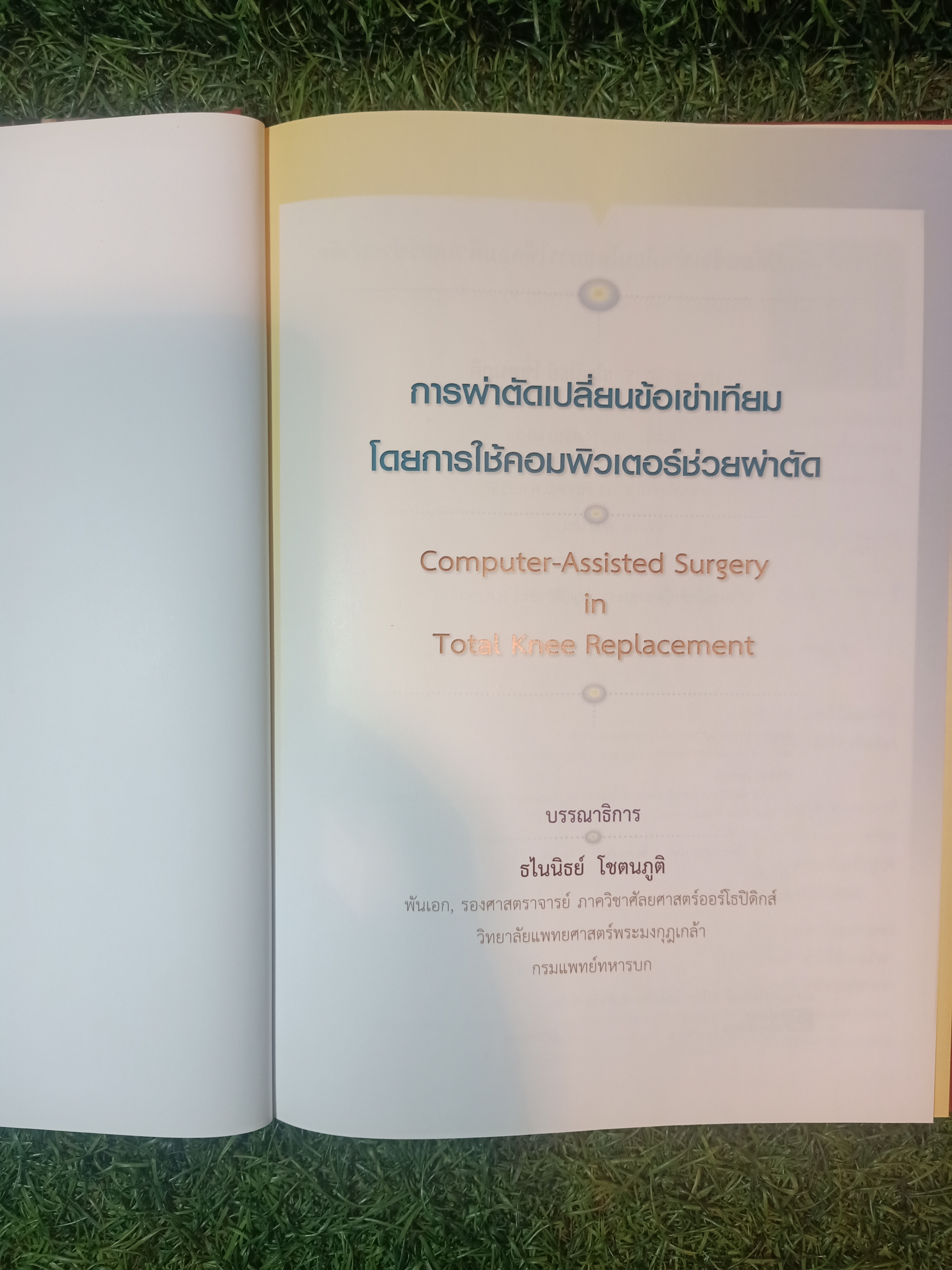 การผ่าตัดเปลี่ยนข้อเข่าเทียม โดยการใช้คอมพิวเตอร์ช่วยผ่าตัด / ธไนนิธย์ โชตนภูมิ