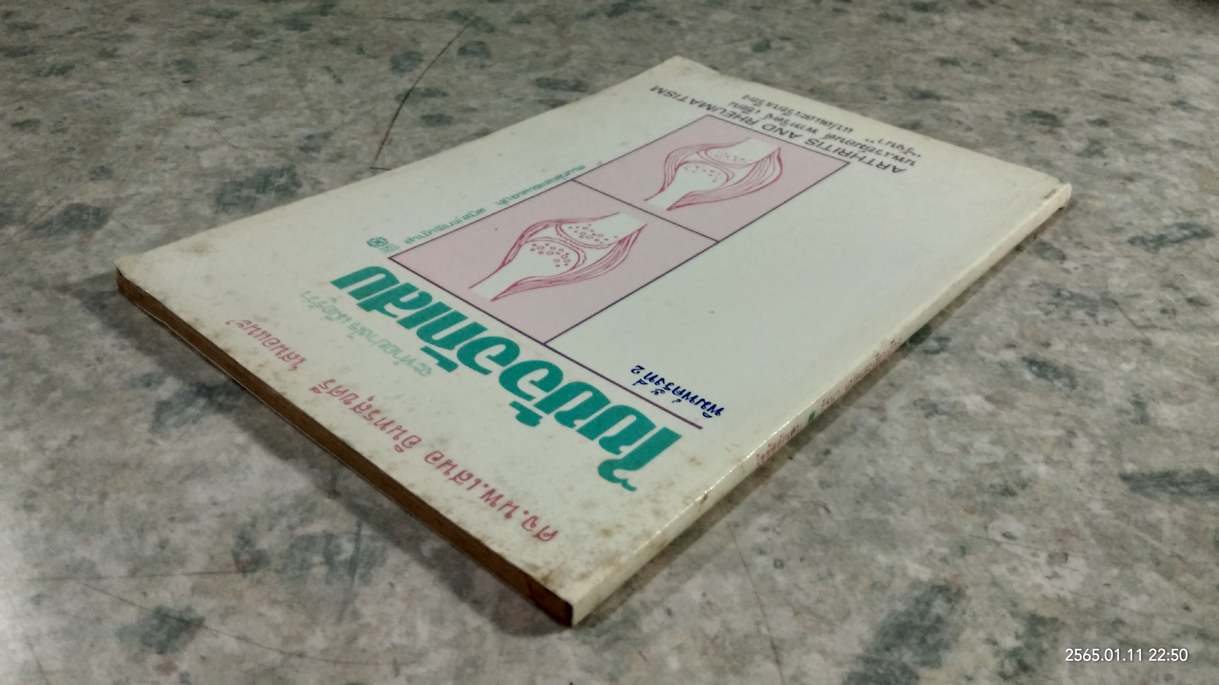 ไขข้ออักเสบ / นพ.เรย์มอนด์ พาทริดจ์